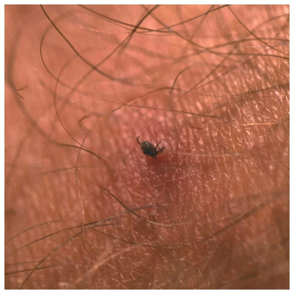 Tire-tique Lifesystems Tick Card White 5 Tire-tique Lifesystems Tick Card White – Image 3